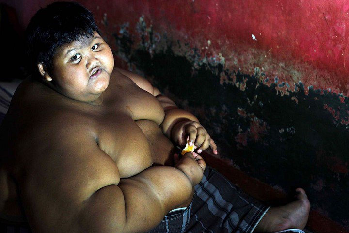 Arya-Permana-enfant-192-kilos-10-ans-indonesie-4