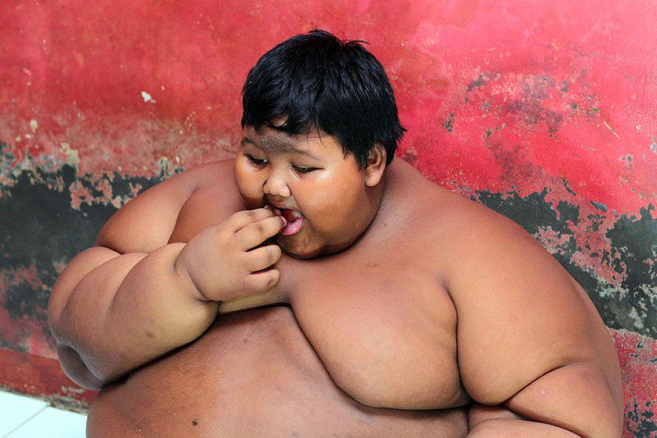Arya-Permana-enfant-192-kilos-10-ans-indonesie-7