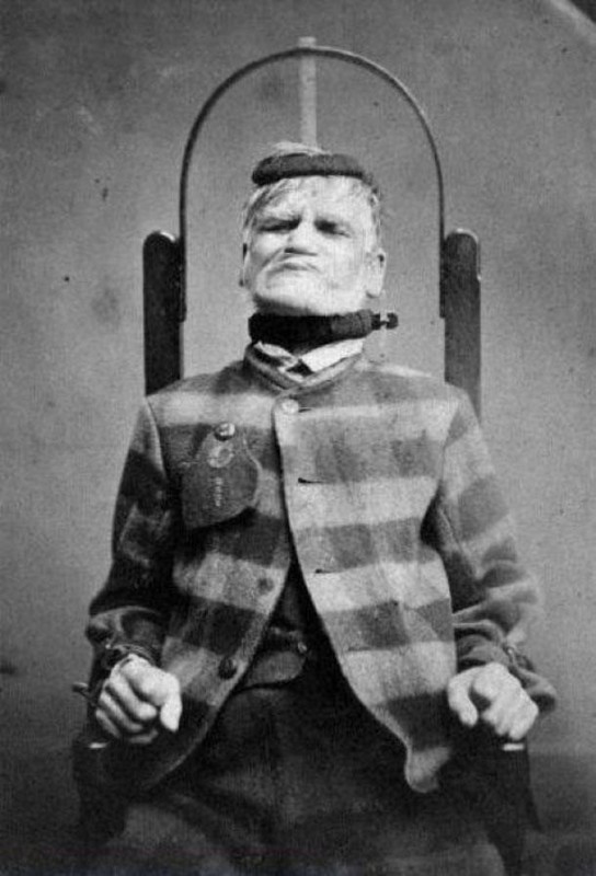 patient-in-restraint-chair-at-the-west-riding-lunatic-asylum-wakefield-yorkshire-ca-1869_04e4cc