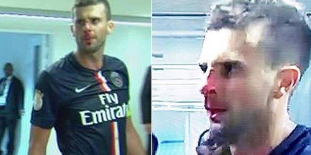 Brandão donne un coup de boule à Thiago Motta. PSG – Bastia