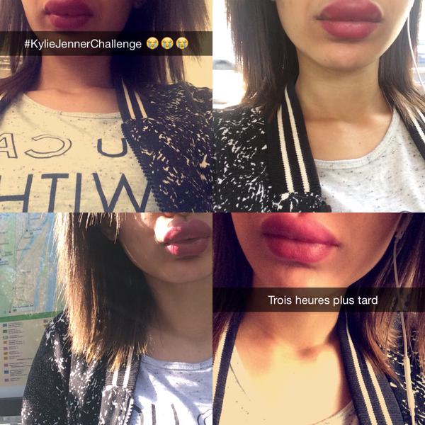 #kyliejennerchallenge, comment faire le buzz pour avoir des pneus à la place des lèvres…