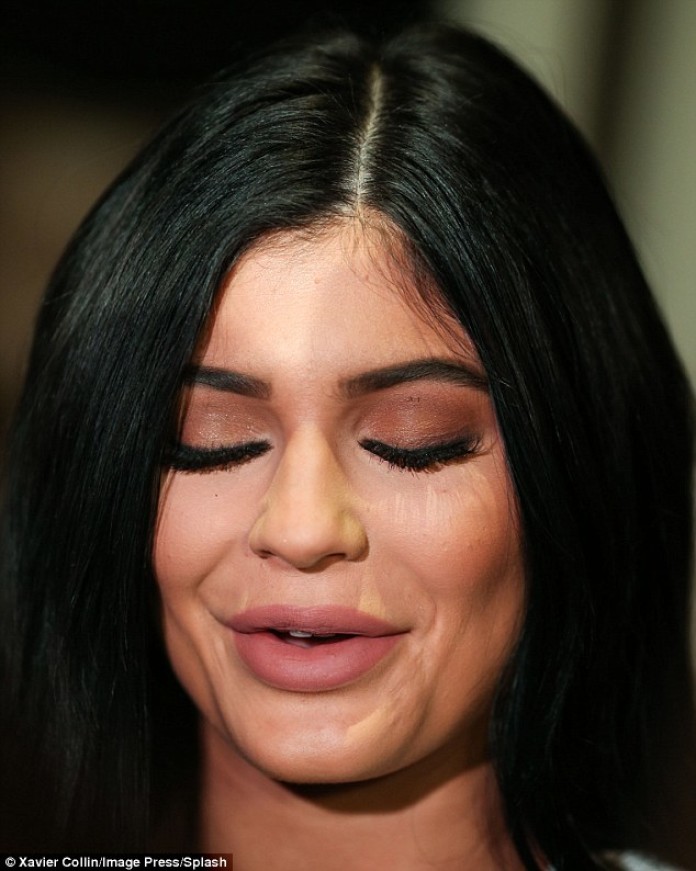 Kylie Jenner Déformée Par La Chirurgie La Photo Choc Est Lexemple Parfait De Labus De La 