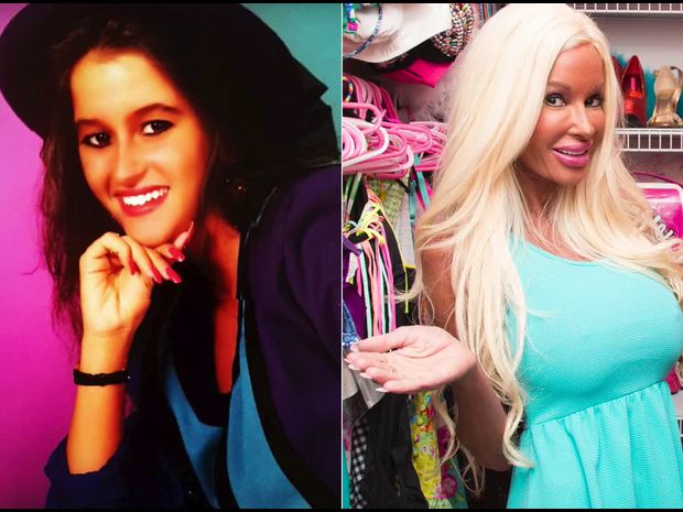 Incroyable, cette femme a dépensé 450 000€ pour ressembler à Barbie…