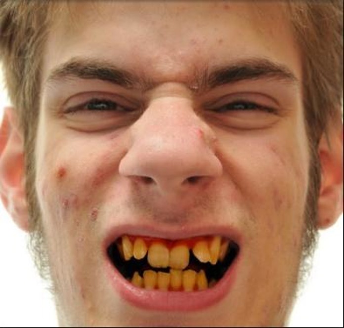 Dent Pour Dent Saison 1 La technique efficace pour avoir les dents blanches ! - Breakforbuzz
