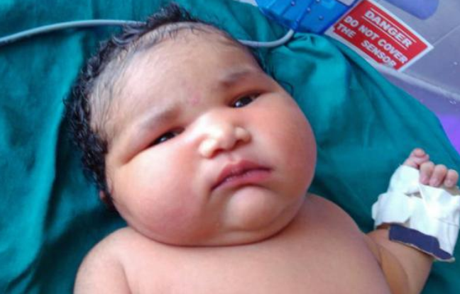En inde, une femme donne naissance à une petite fille de 6,8 kilos