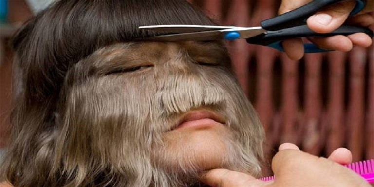 5 maladies rares & étranges