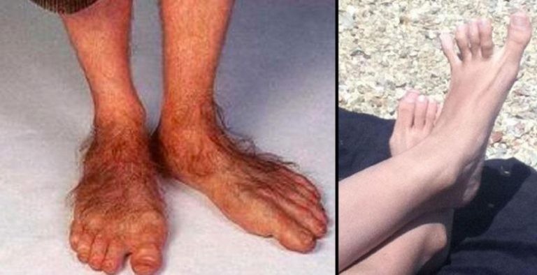 Tour du web, des gens qui ont les pieds bien dégueulasses…
