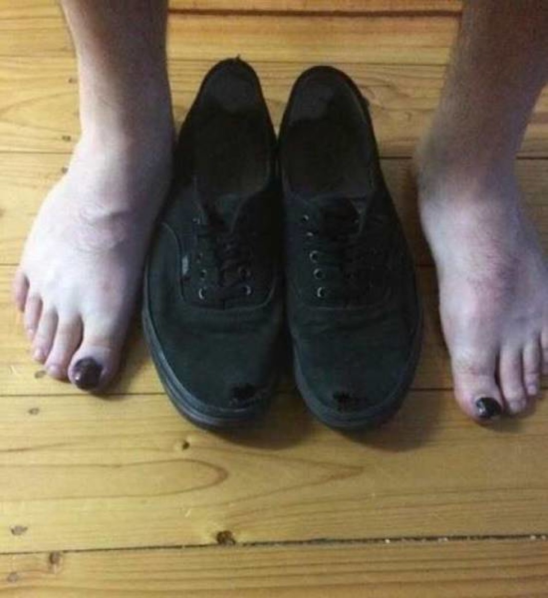 Порванные носки туфли
