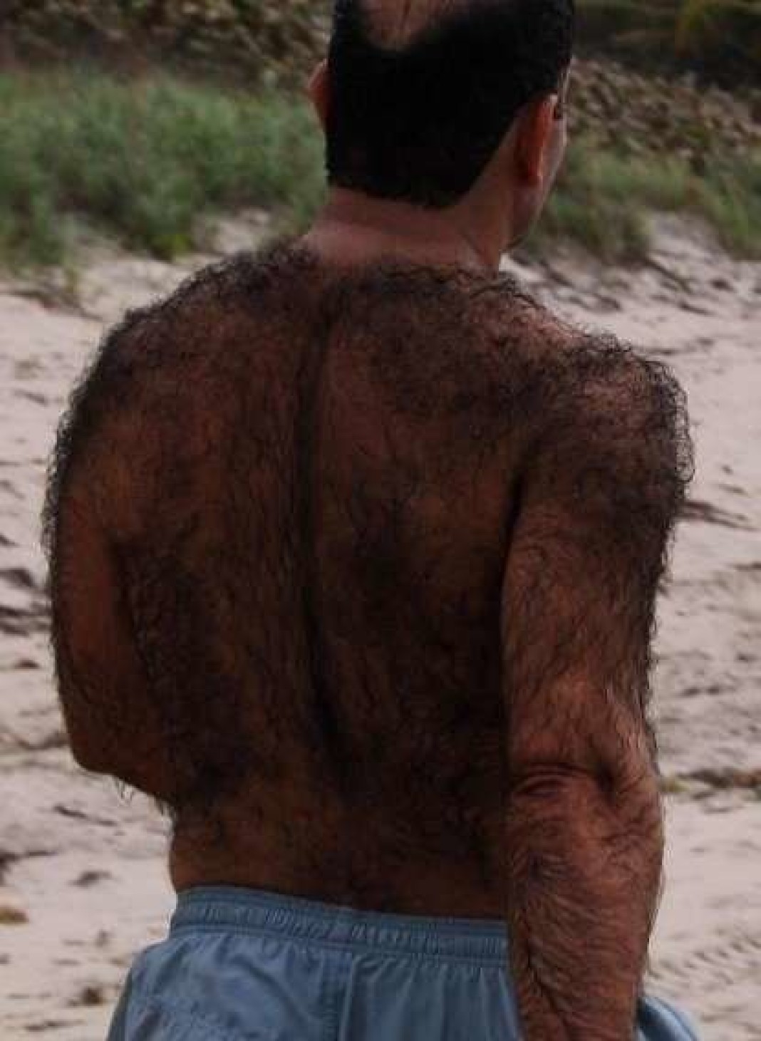 Человеческая шерсть. Волосатая спина у мужчин. Очень волосатый мужчина.