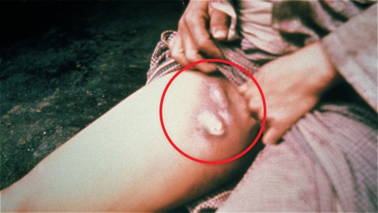 5 MALADIES causant la MORT RAPIDEMENT !