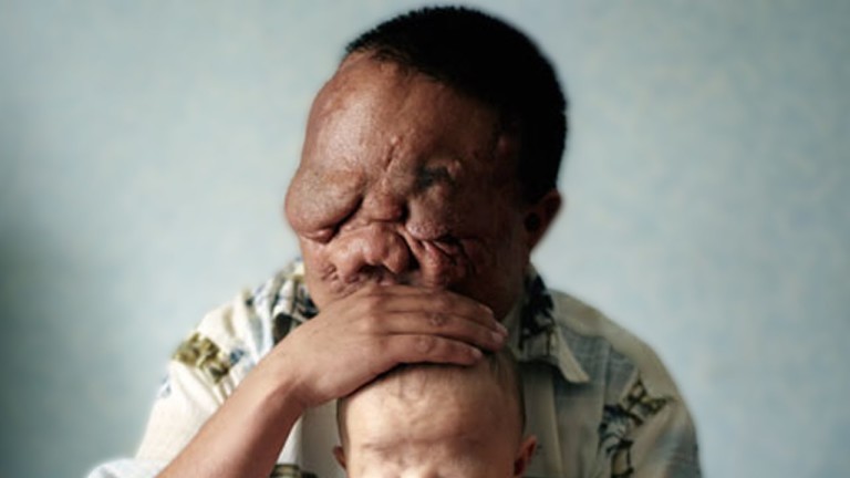 5 MUTATIONS GÉNÉTIQUES chez L&rsquo;HOMME !