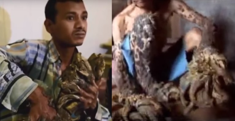 Top 10 des MALADIES les plus ÉTRANGES !