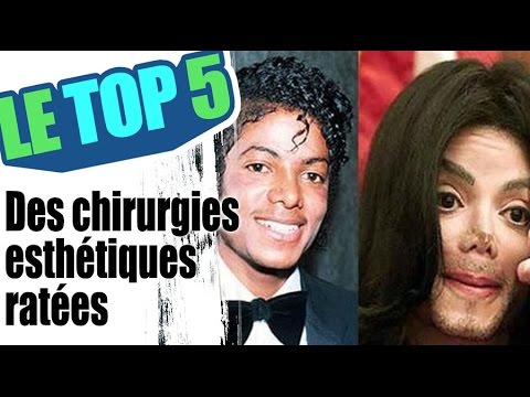 Le top 5 des chirurgies esthétiques ratées