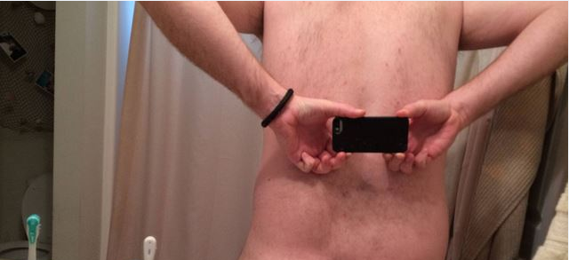 Un homme sans fesses intrigue la curiosité des internautes…