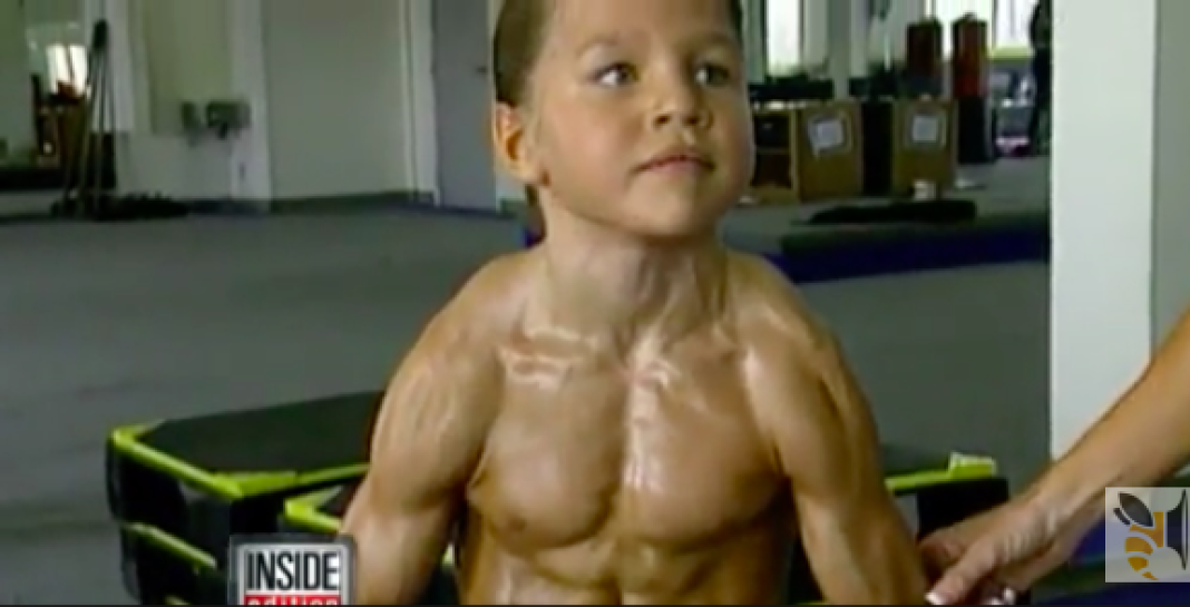 La Personne La Plus Muscle Du Monde Regardez ce qu’est devenu l’enfant le plus musclé du monde ! - Breakforbuzz