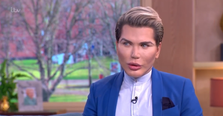 Il dépense 435 000 euros pour ressembler à la poupée Ken !