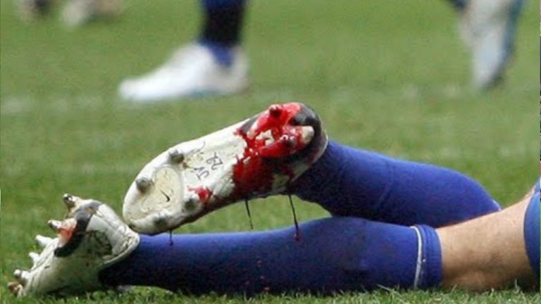 LES 10 PIRES SCANDALES DU FOOT FRANÇAIS