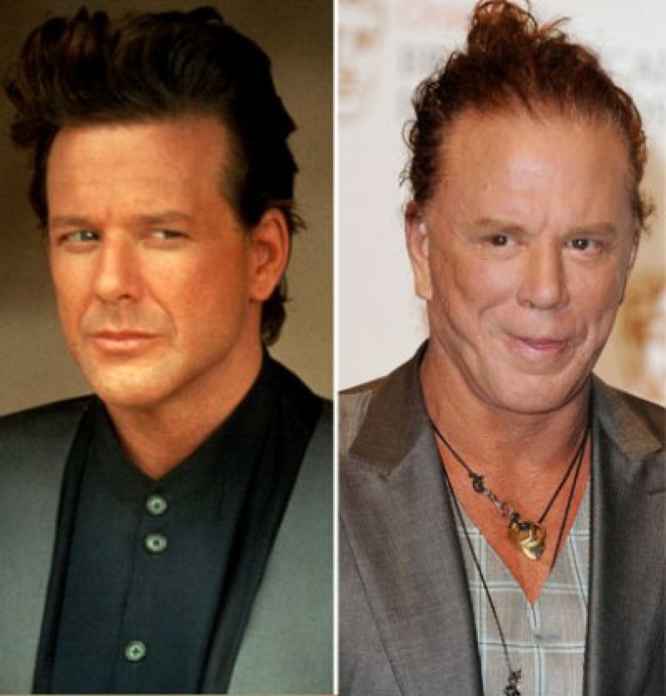 top 98+ Pictures mickey rourke before and after plastic surgery pictures Excellent