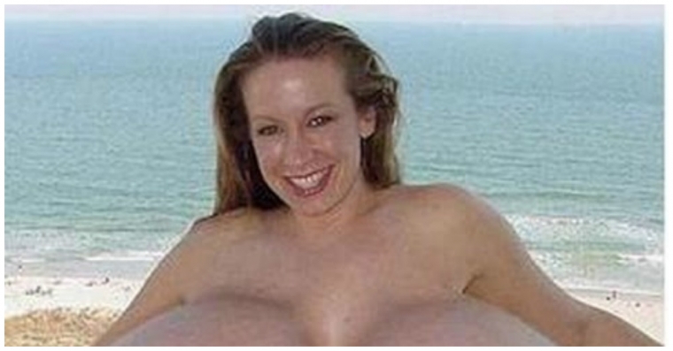 18 augmentations mammaires horriblement ratées!