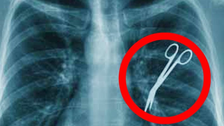 TOP 5 DES PIRES ERREURS MÉDICALES