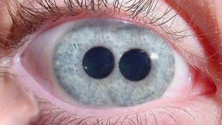 5 GADGETS QUI VOUS DONNENT DE VRAIS SUPER POUVOIRS