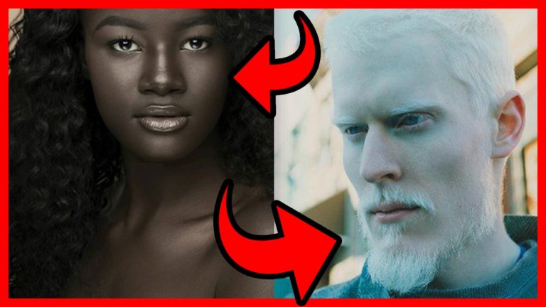 5 PERSONNES avec une COULEUR de PEAU UNIQUE !