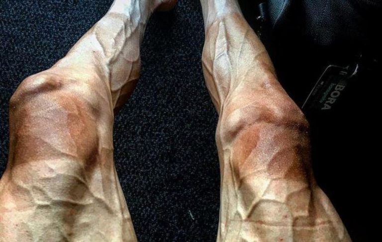 Après 16 étapes du Tour de France, les jambes du coureur Poljanski sont effrayante…