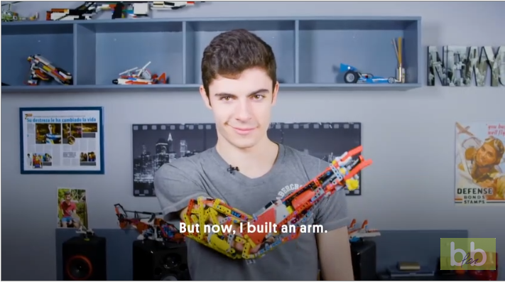 Il construit sa prothèse de bras en LEGO