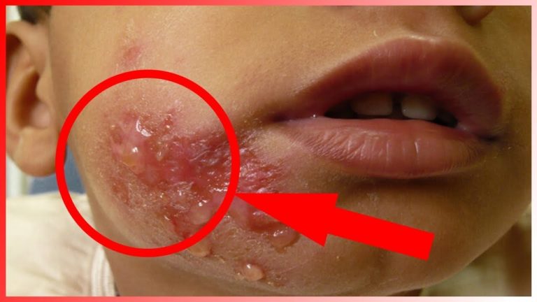 10 FAITS que vous IGNOREZ sur les MOUSTIQUES