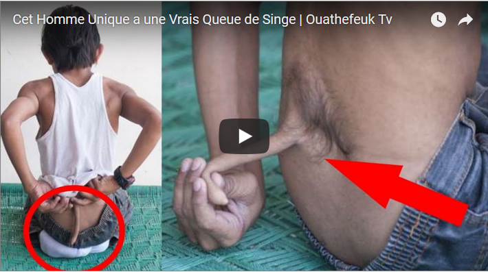 Cet homme unique a une vraie queue de singe