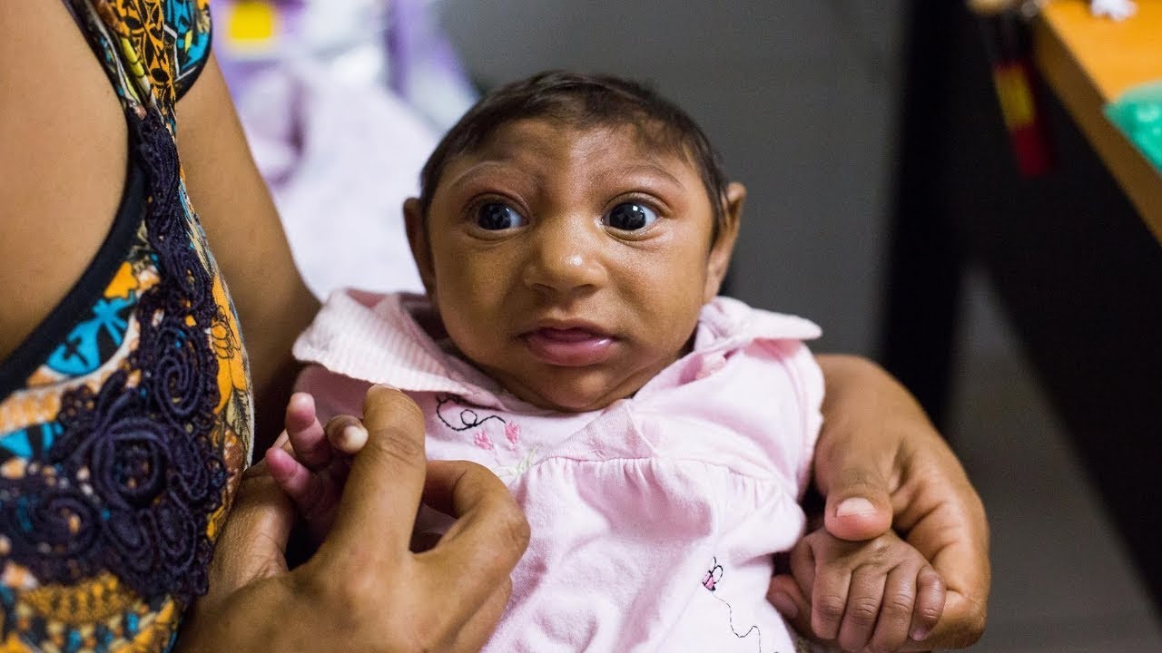 Ces Enfants Uniques Ont Choqu s Le Monde Breakforbuzz