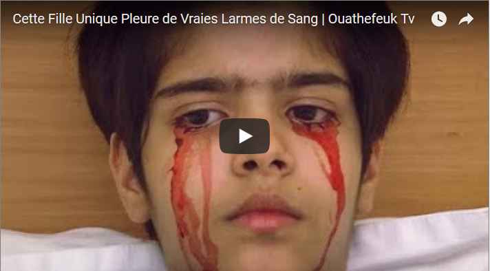 Cette fille unique pleure de vraies Larmes de Sang
