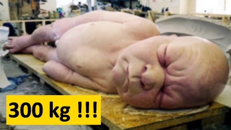 Cette femme de 272 kg a donné naissance a un géant