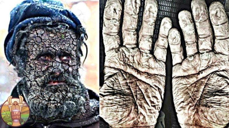 Un indien ne s’est pas lavé depuis plus de 44 ans!