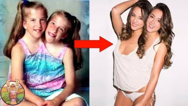 10 FRÈRES ET SOEURS SIAMOIS QUI EXISTENT DANS LE MONDE