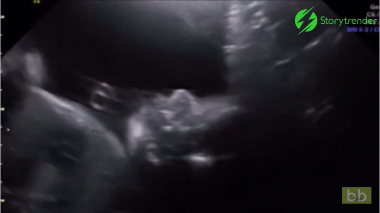 Dans le ventre de maman, ce bébé fait coucou